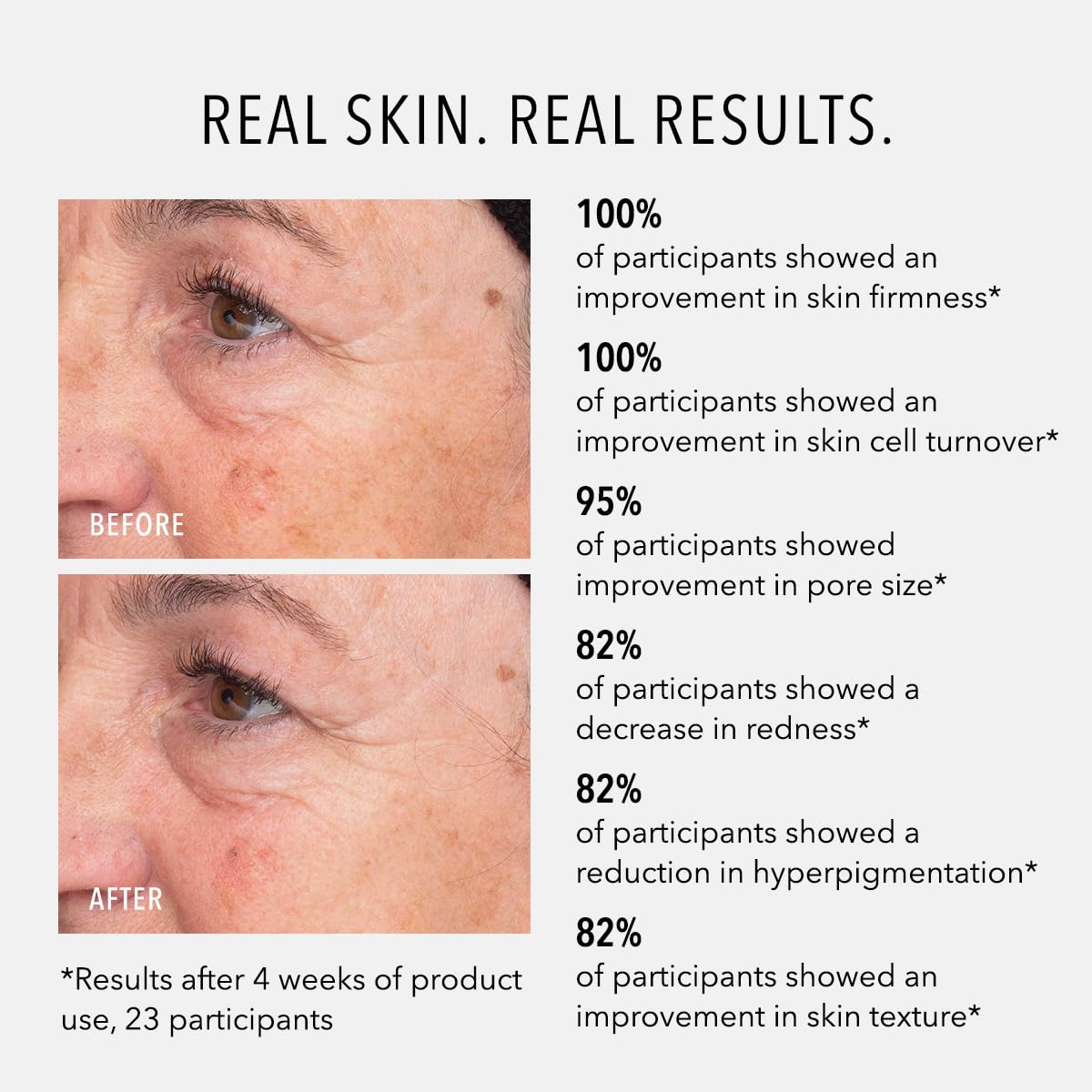 HydroPeptide Liquid Resurfacing Solution, Daily Leave-On Peptide Exfoliant with 2% Salicylic Acid, Exfoliate & Illuminate, 4 Ounce