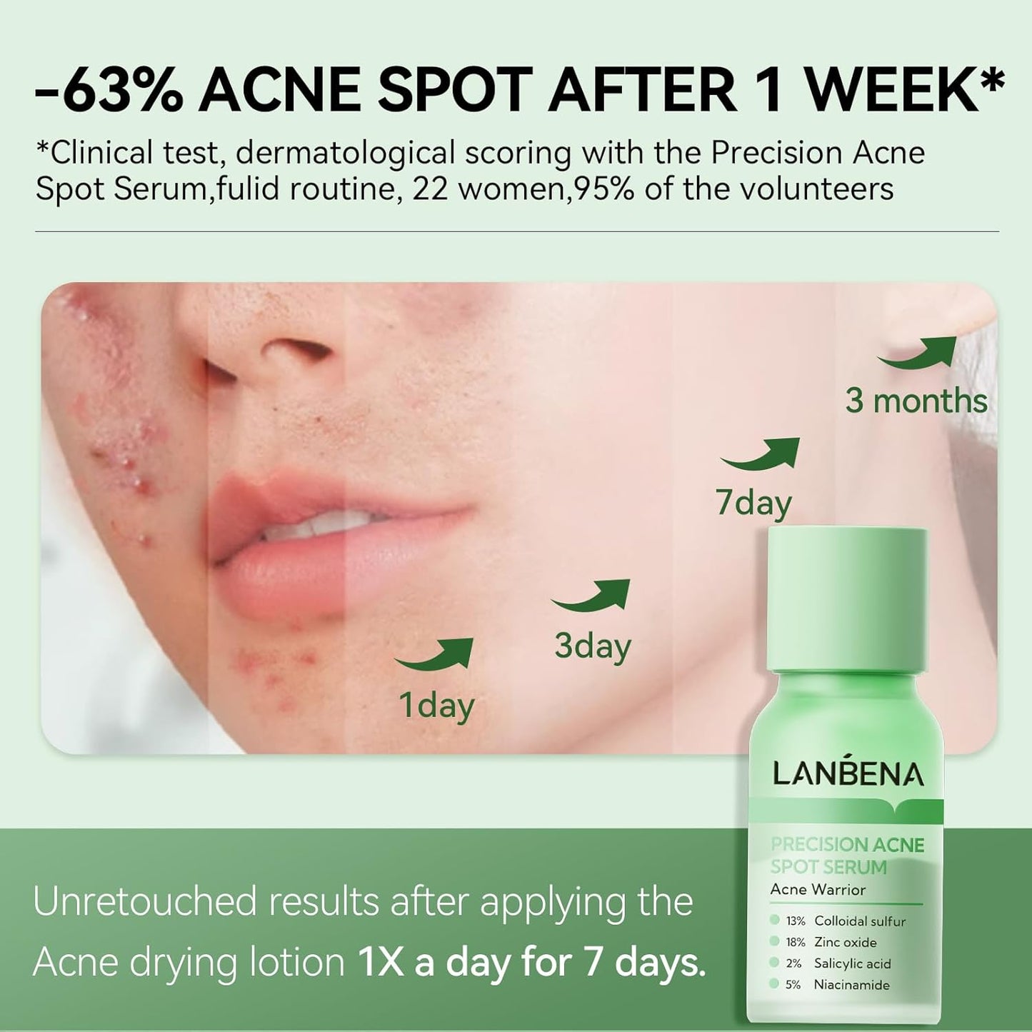 LANBENA 2% Salicylic Acid Spot Serum, 8H Rapid Acne Treatment for Acne-Prone Sensitive Skin, Fast-Acting Dry Out Pimples, Fade Acne Marks, Redness Relief, Overnight & Period Breakouts, 0.42 Fl Oz